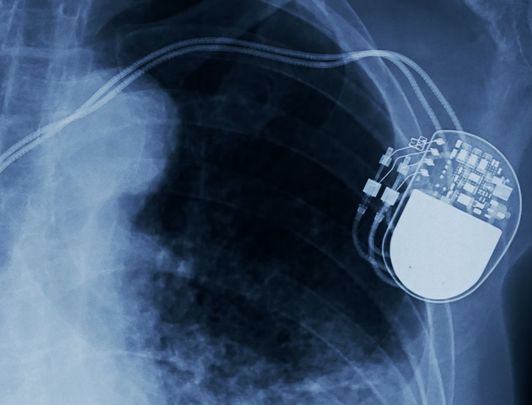 How small can we go? Designing the next generation of implantable ...